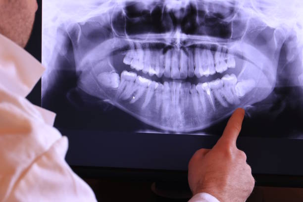 Best Emergency Tooth Extraction  in Hudson, NC