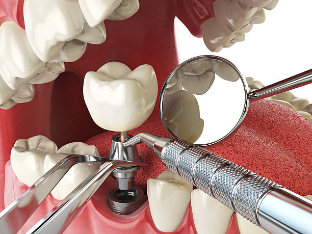 Best Cracked Tooth Emergency Dentist  in Hudson, NC